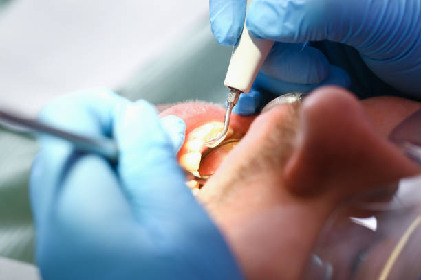 Best Dentist for Severe Toothache  in Pocono Ranch Lands, PA